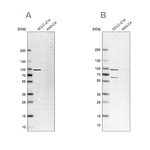 PNPase Antibody in Western Blot (WB)
