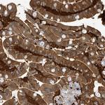 FABP2 Antibody in Immunohistochemistry (Paraffin) (IHC (P))