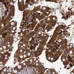 FABP2 Antibody in Immunohistochemistry (Paraffin) (IHC (P))