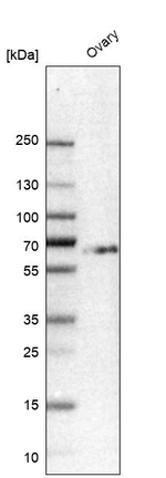 HS6ST2 Antibody in Western Blot (WB)