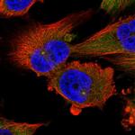 Dynactin 1 Polyclonal Antibody