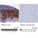 TXNDC5 Antibody
