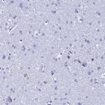 TXNDC5 Antibody in Immunohistochemistry (Paraffin) (IHC (P))