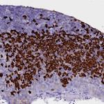 TXNDC5 Antibody in Immunohistochemistry (Paraffin) (IHC (P))