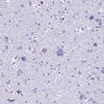 TXNDC5 Antibody in Immunohistochemistry (Paraffin) (IHC (P))