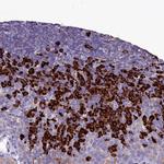 TXNDC5 Antibody in Immunohistochemistry (Paraffin) (IHC (P))