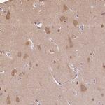 PLCB1 Antibody in Immunohistochemistry (Paraffin) (IHC (P))