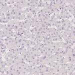 PLCB1 Antibody in Immunohistochemistry (Paraffin) (IHC (P))