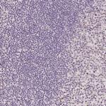 PLCB1 Antibody in Immunohistochemistry (Paraffin) (IHC (P))