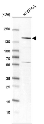 KIF4A Antibody in Western Blot (WB)
