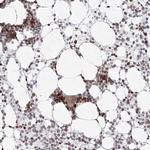 KIF4A Antibody in Immunohistochemistry (Paraffin) (IHC (P))