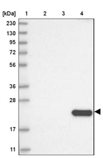 Tetranectin Antibody in Western Blot (WB)