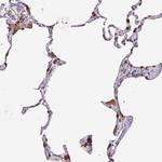 SFTPB Antibody in Immunohistochemistry (Paraffin) (IHC (P))