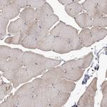 DRAK2 Polyclonal Antibody