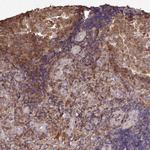 DRAK2 Antibody in Immunohistochemistry (Paraffin) (IHC (P))