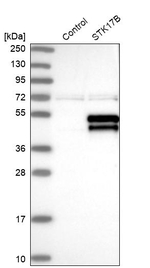 DRAK2 Antibody in Western Blot (WB)