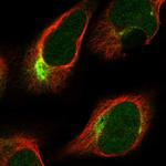 PKN2 Polyclonal Antibody