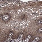 PKN2 Antibody in Immunohistochemistry (Paraffin) (IHC (P))