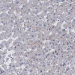 PKN2 Antibody in Immunohistochemistry (Paraffin) (IHC (P))