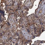 PKN2 Antibody in Immunohistochemistry (Paraffin) (IHC (P))