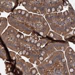 PKN2 Antibody in Immunohistochemistry (Paraffin) (IHC (P))