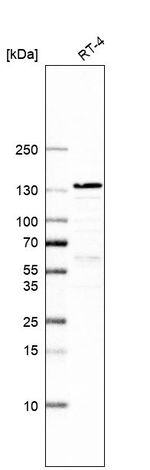 PKN2 Antibody in Western Blot (WB)