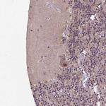 UBA3 Polyclonal Antibody