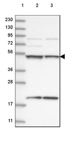 UBA3 Antibody in Western Blot (WB)