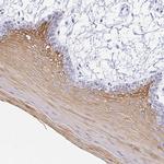 Cytokeratin 4 Antibody in Immunohistochemistry (Paraffin) (IHC (P))