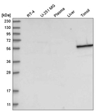 Cytokeratin 4 Antibody in Western Blot (WB)