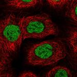 BACH1 Polyclonal Antibody