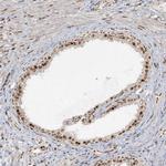 RBM10 Antibody in Immunohistochemistry (Paraffin) (IHC (P))