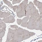 RBM10 Antibody in Immunohistochemistry (Paraffin) (IHC (P))