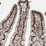 RBM10 Antibody in Immunohistochemistry (Paraffin) (IHC (P))