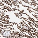 ABCB7 Antibody in Immunohistochemistry (Paraffin) (IHC (P))