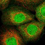 ZNF213 Polyclonal Antibody