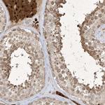 ZNF213 Antibody in Immunohistochemistry (Paraffin) (IHC (P))