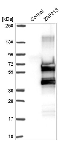 ZNF213 Antibody in Western Blot (WB)