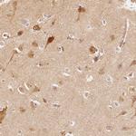 GRAF Antibody in Immunohistochemistry (Paraffin) (IHC (P))