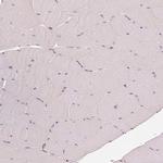 GRAF Antibody in Immunohistochemistry (Paraffin) (IHC (P))