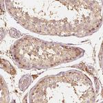 GRAF Antibody in Immunohistochemistry (Paraffin) (IHC (P))