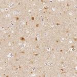 GRAF Antibody in Immunohistochemistry (Paraffin) (IHC (P))