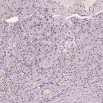 GRAF Polyclonal Antibody