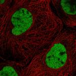 DNA-PK Polyclonal Antibody