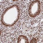 DNA-PK Antibody in Immunohistochemistry (Paraffin) (IHC (P))