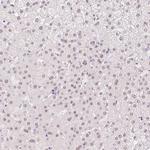 HNF1A Antibody in Immunohistochemistry (Paraffin) (IHC (P))
