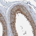 ASCT2 Antibody in Immunohistochemistry (Paraffin) (IHC (P))