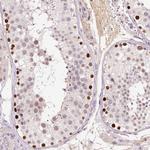 DPPA4 Antibody in Immunohistochemistry (Paraffin) (IHC (P))
