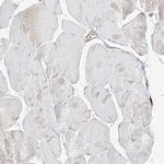 FSTL1 Antibody in Immunohistochemistry (Paraffin) (IHC (P))