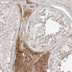 FSTL1 Antibody in Immunohistochemistry (Paraffin) (IHC (P))